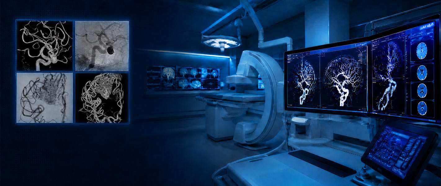 Unidad de Neurorradiología Intervencionista HM Modelo